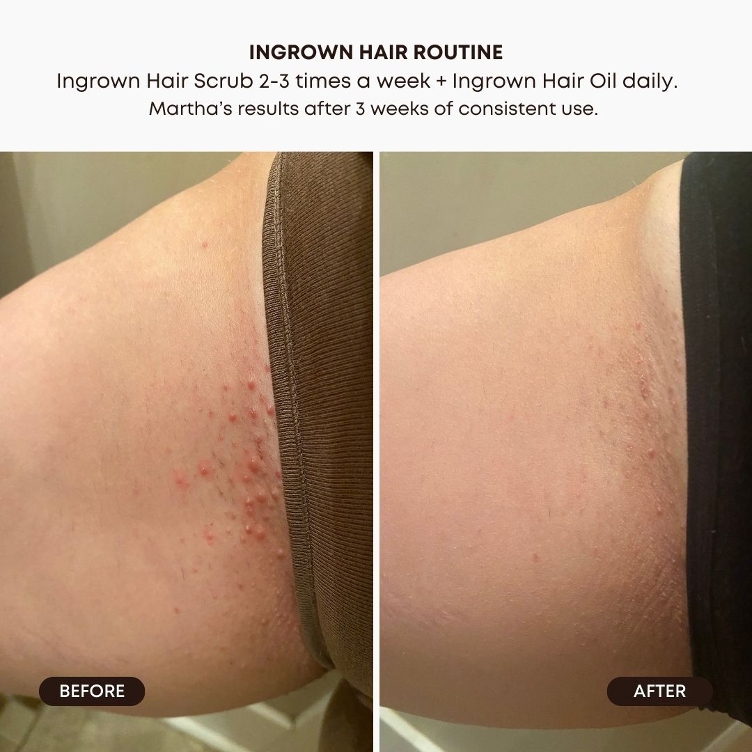 Watermelon Sugar Exfoliating Scrub