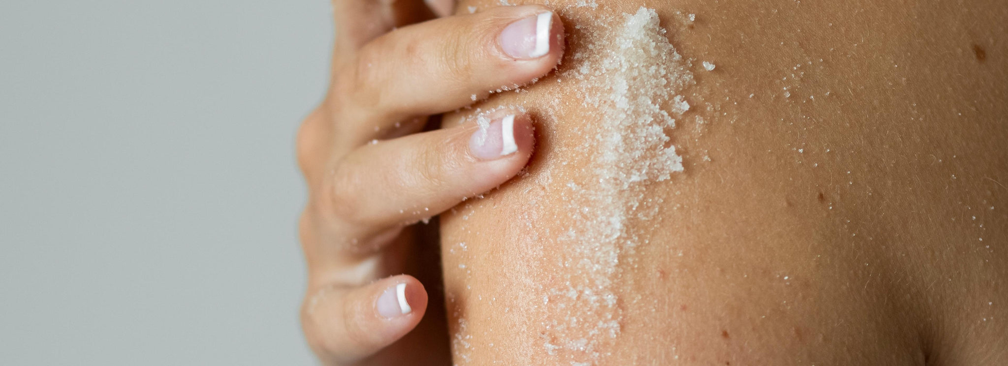 What Causes Keratosis Pilaris (Chicken Skin)