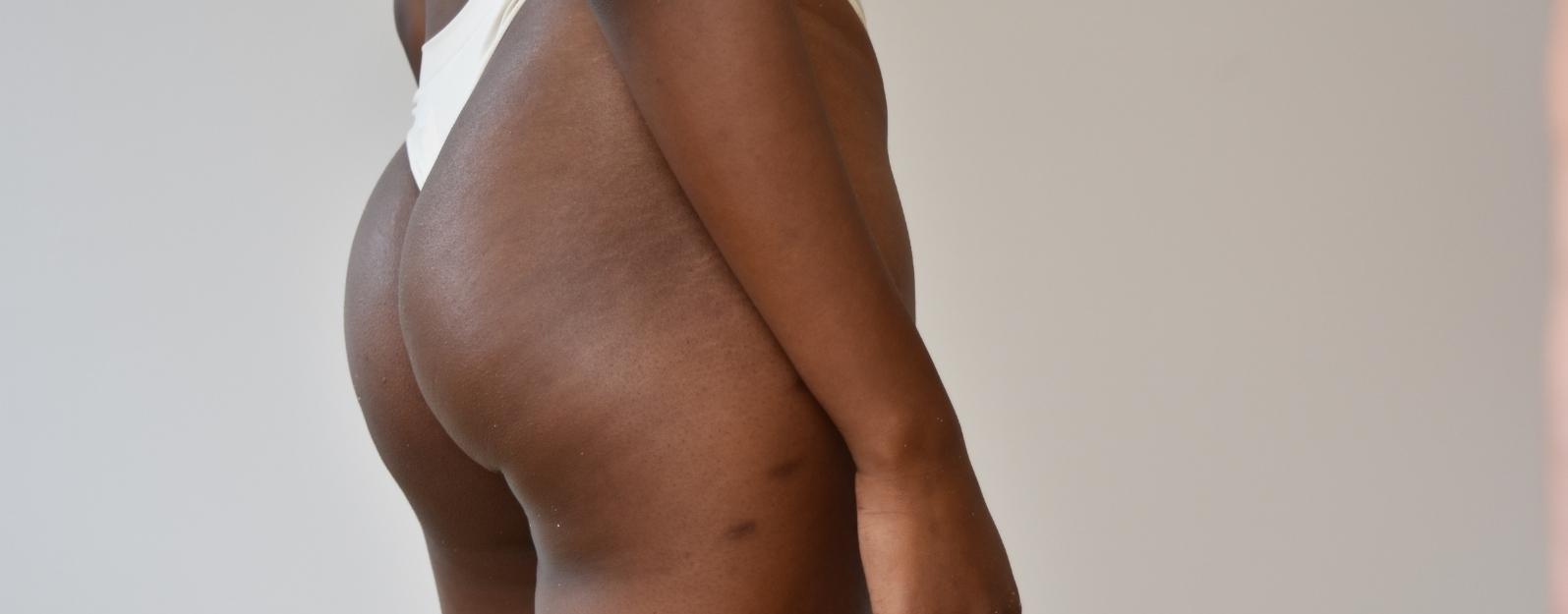 Why the Skin Feels Tight and Itchy After the Shower