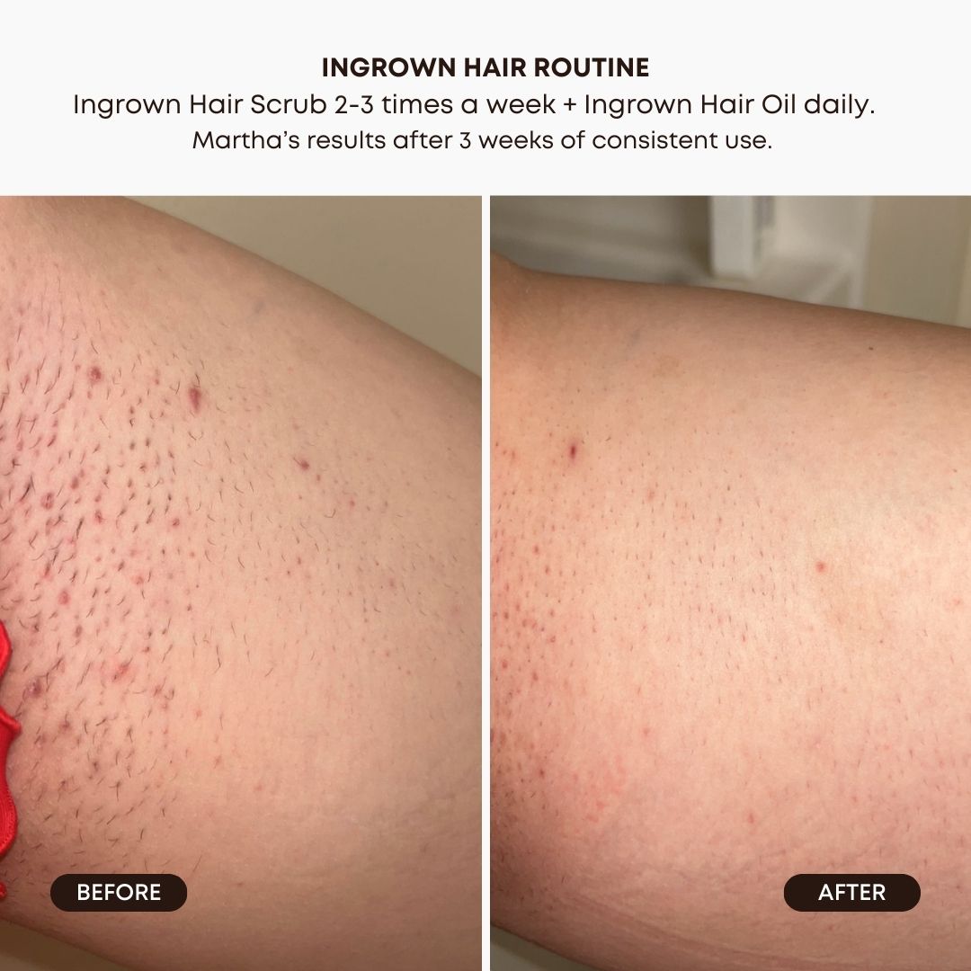 Watermelon Sugar Exfoliating Scrub Value Pack