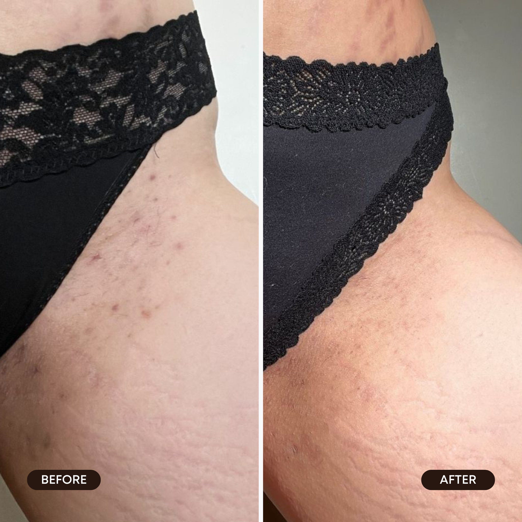 Cozy Cashmere Ingrown Hair 2 Step Routine