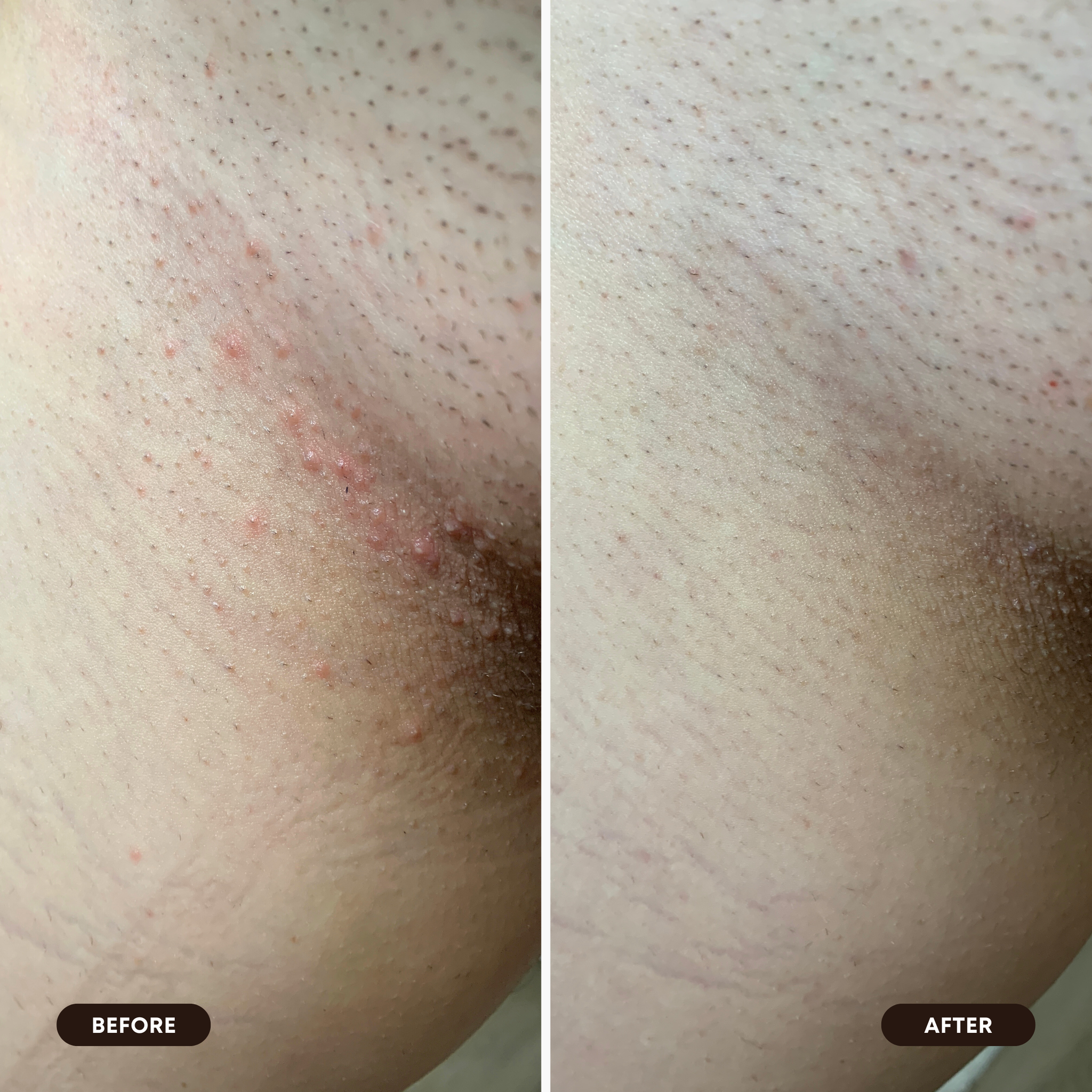 2025 Limited Edition 2-Step Set