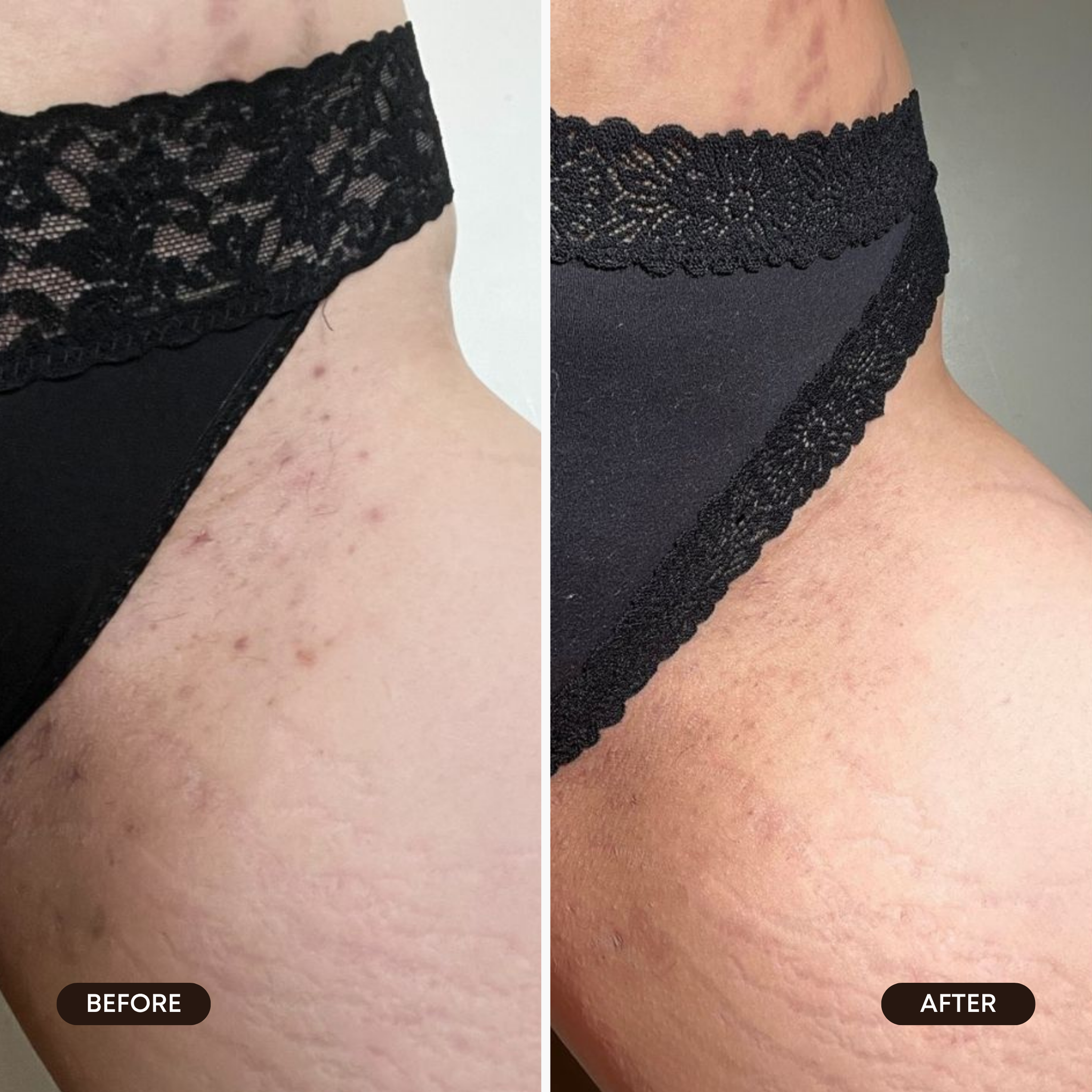 Cozy Cashmere Ingrown Hair Oil