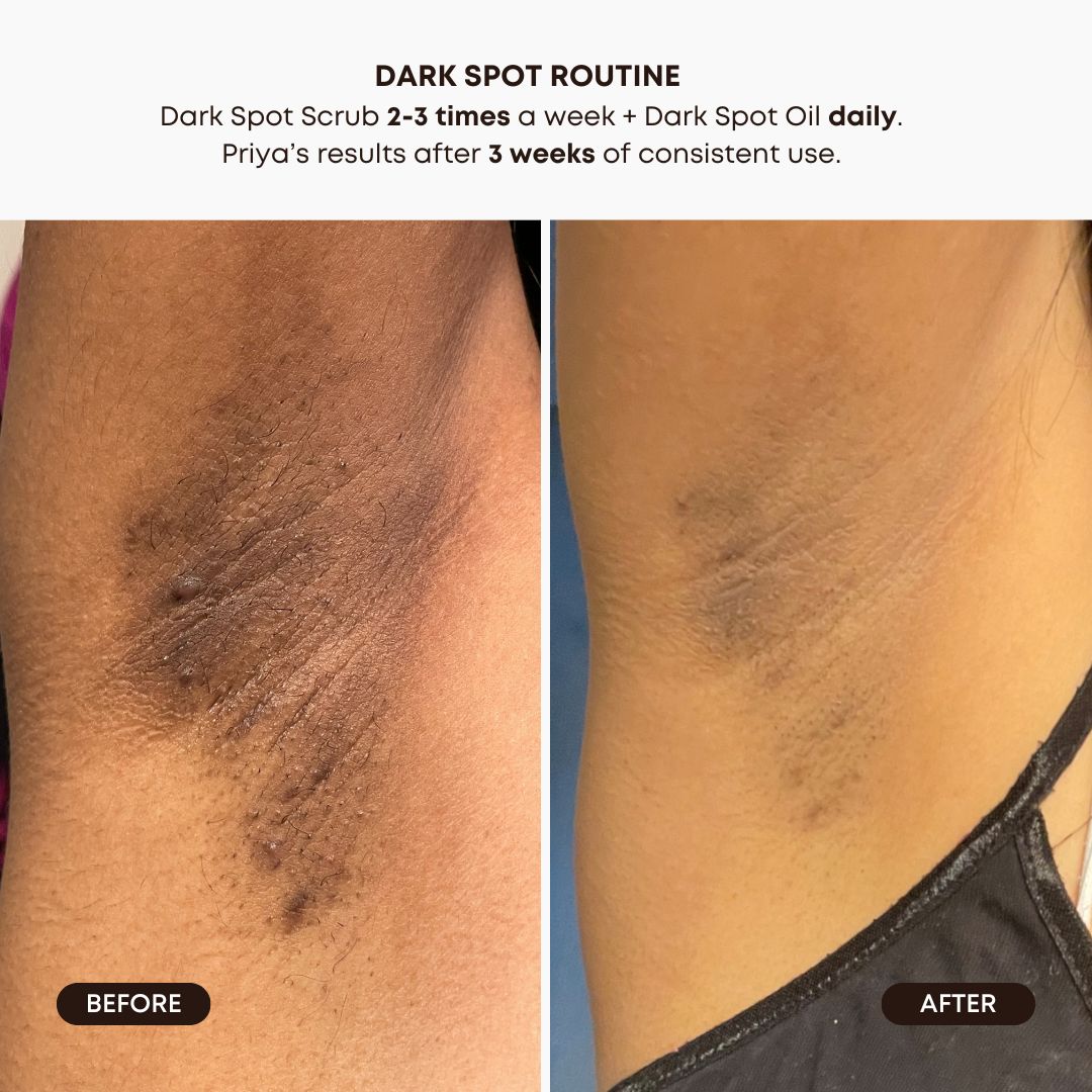 Lavender Lemon Dark Spot Oil