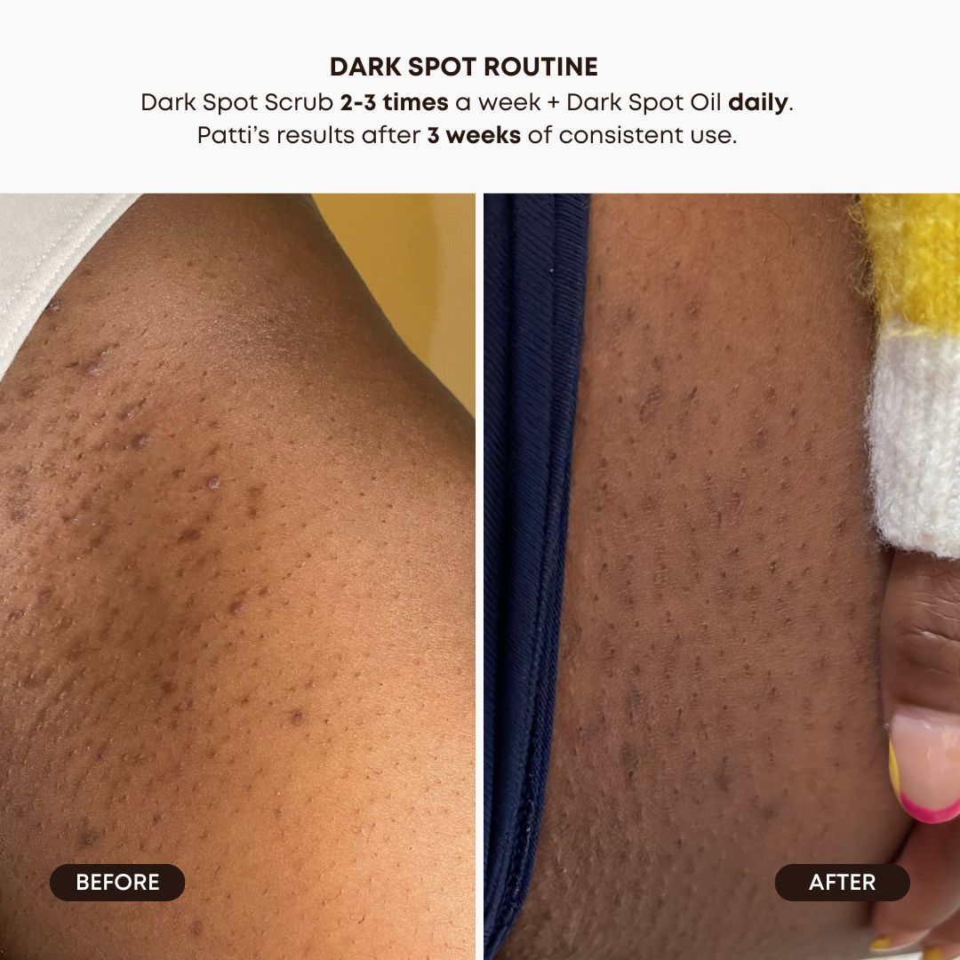 Lavender Lemon Dark Spot Oil